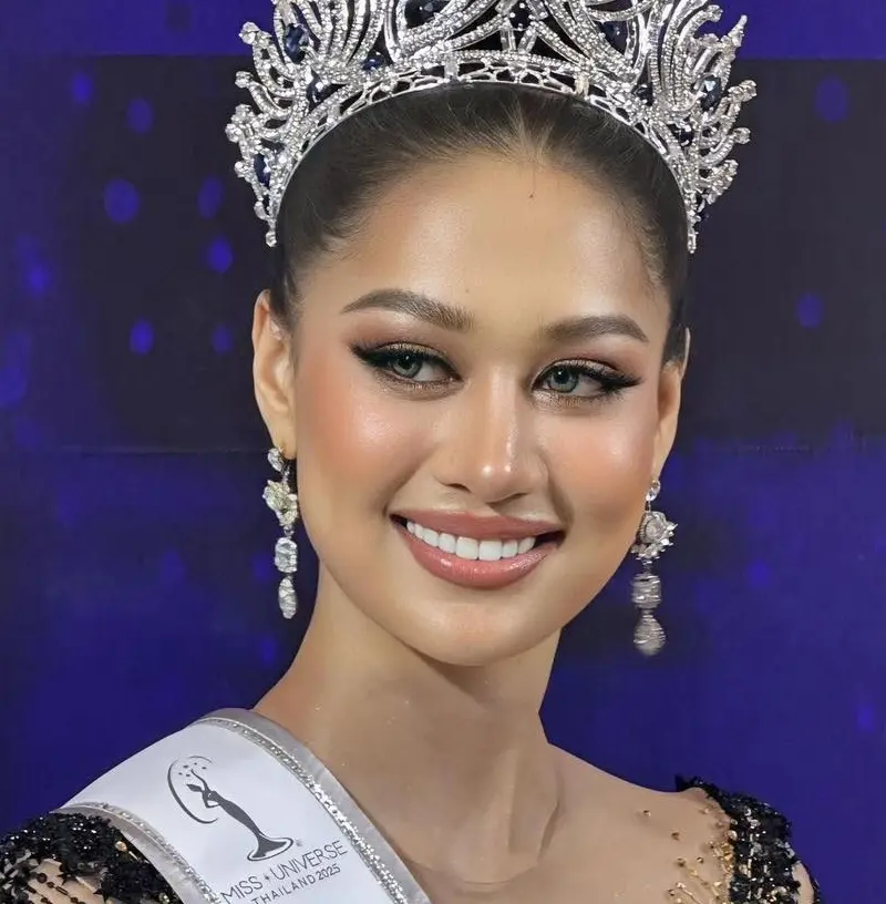 Miss Universe Thailand 2025 with Veneers by Mammos